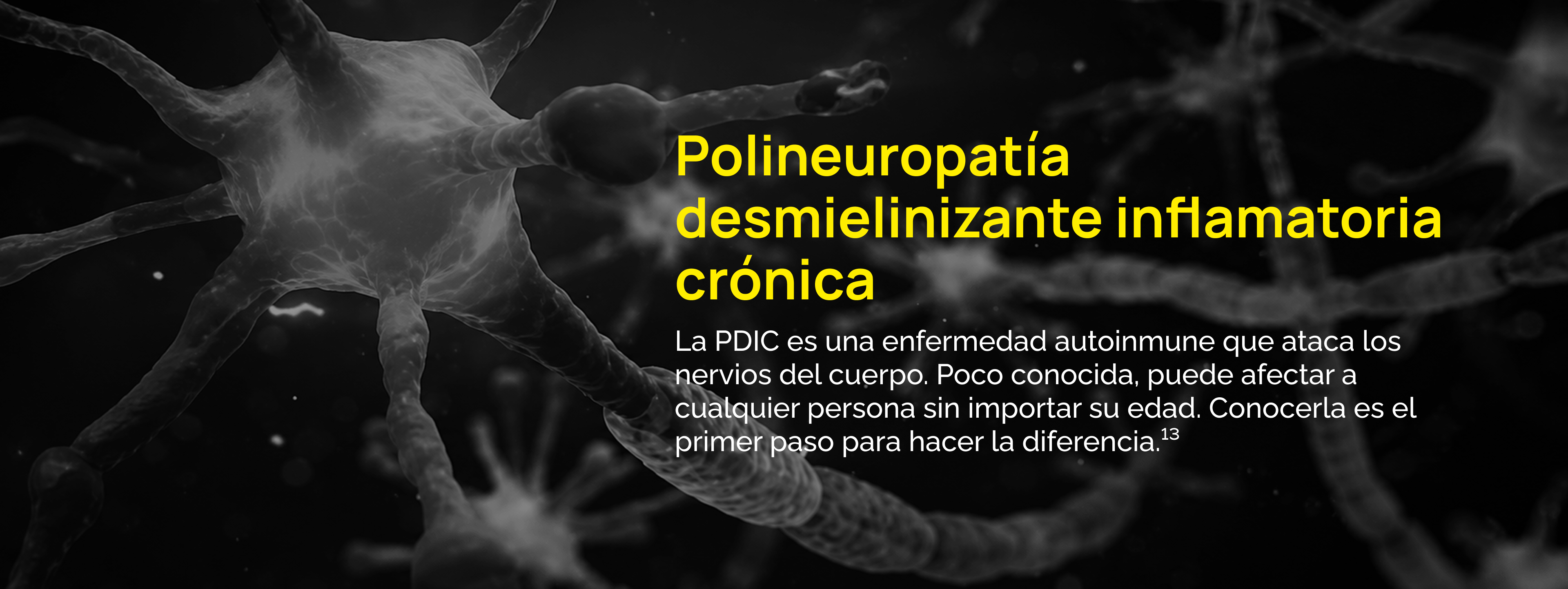 Polineuropatía desmielinizante inflamatoria crónica. La PDIC es una enfermedad autoinmune que ataca los nervios del cuerpo. Poco conocida, puede afectar a cualquier persona sin importar su edad. Conocerla es el primer paso para hacer la diferencia. Referencia 13.